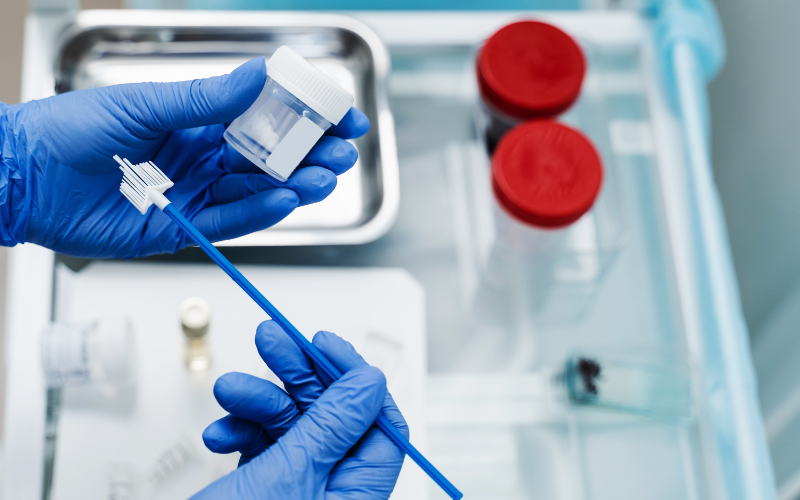 Xét nghiệm hpv nam giới có thực hiện được không? 2