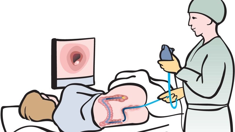 xet-nghiem-ky-sinh-trung-duong-ruot-gom-co-nhung-phuong-phap-nao 4