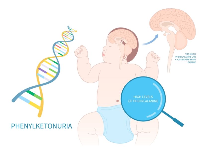 Xét nghiệm lấy máu gót chân 73 bệnh gồm những bệnh gì? 4