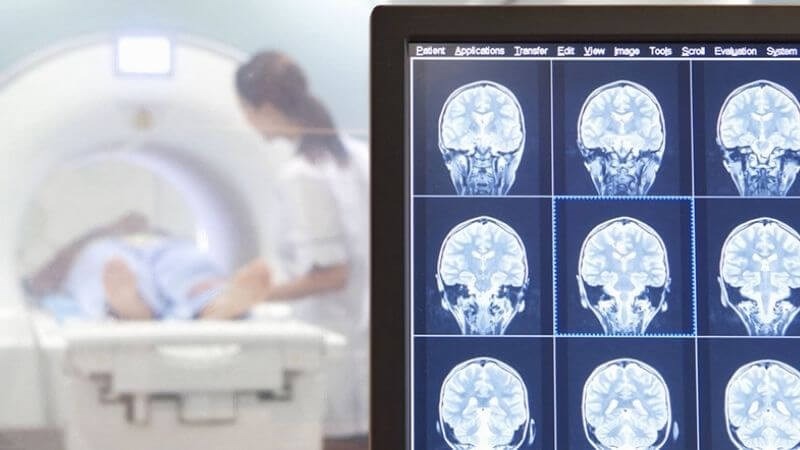 Xét nghiệm máu có biết u não không? 1