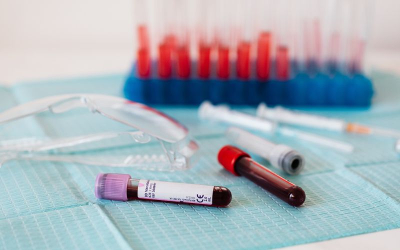 Xét nghiệm nhiễm sắc thể có thể được thực hiện ở bất kỳ thời điểm nào, không phụ thuộc vào chu kỳ sinh sản