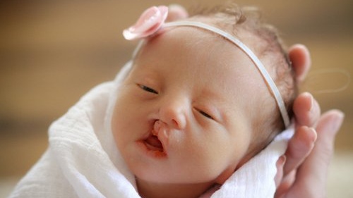 Xét nghiệm NIPT phát hiện những bệnh gì? 4