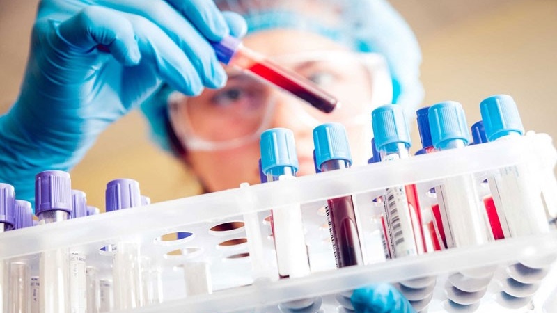 Xét nghiệm NK là gì? Những điều cần biết 2