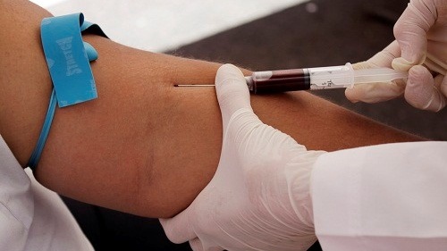 Xét nghiệm NSE là gì? Những điều cần biết 3