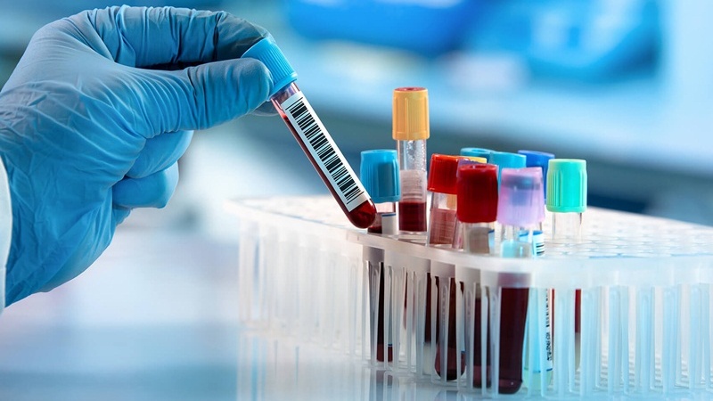 Xét nghiệm Rotem là gì? Lợi ích và nguyên tắc hoạt động của Rotem 2