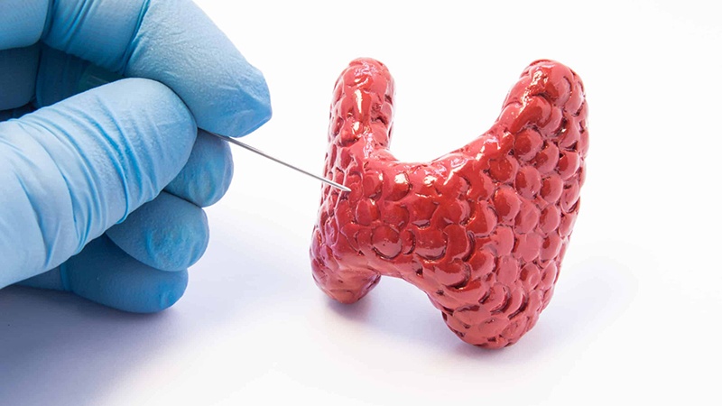 Xét nghiệm sinh thiết bao lâu có kết quả? 2