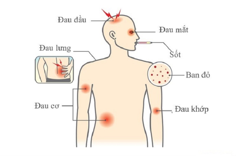 Xét nghiệm sốt xuất huyết ở đâu TP.HCM uy tín? 2