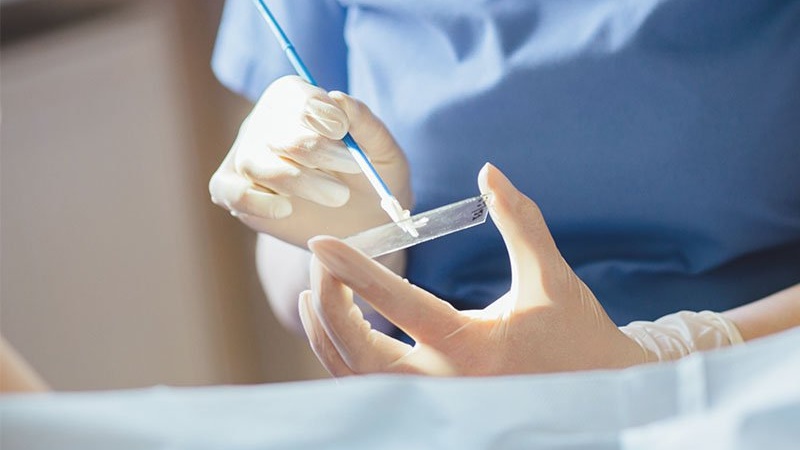 Xét nghiệm tế bào học là gì? Các loại xét nghiệm tế bào học 4