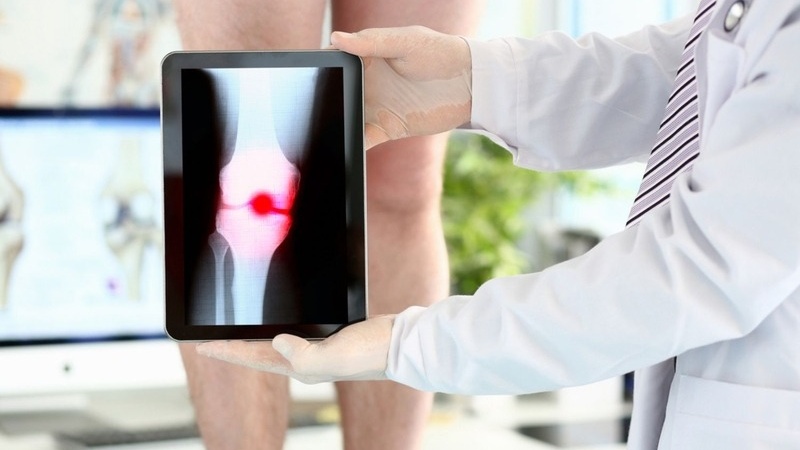 Xét nghiệm viêm khớp giúp đánh giá chính xác tình trạng bệnh
