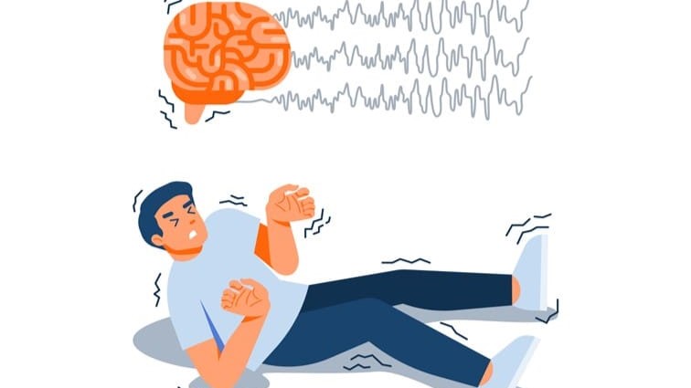 Xơ cứng củ là gì? Nguyên nhân, triệu chứng và cách điều trị 4