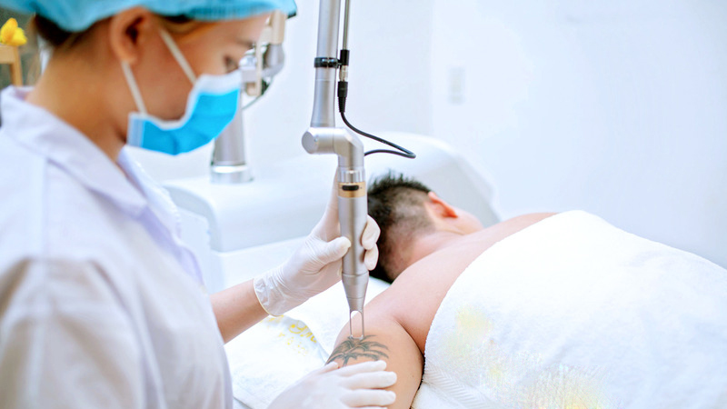 Xóa xăm bao nhiêu tiền? 4