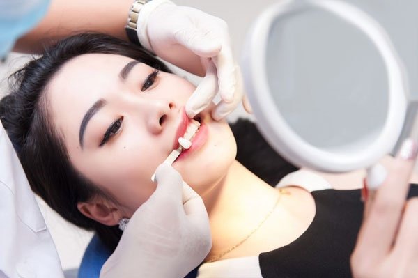 xu-huong-trong-rang-khenh-va-nhung-dieu-can-biet 2.jpg