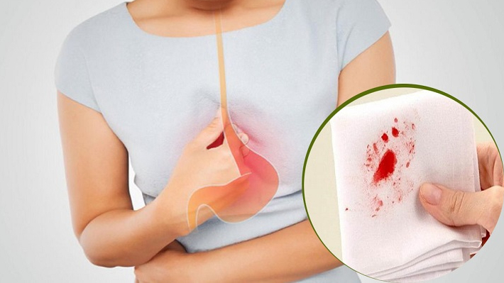 xuat-huyet-niem-mac-da-day-va-nhung-dieu-can-biet 3.jpg