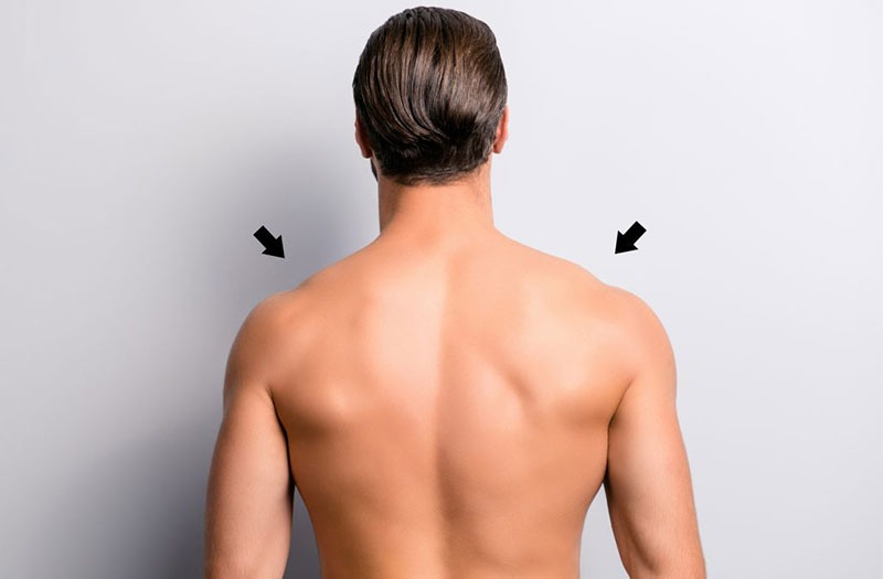 Xương bả vai nhô cao: Dấu hiệu nhận biết, cách chẩn đoán và điều trị 1