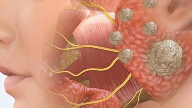 Xương hàm: Cấu tạo, chức năng và một số bệnh lý liên quan 4