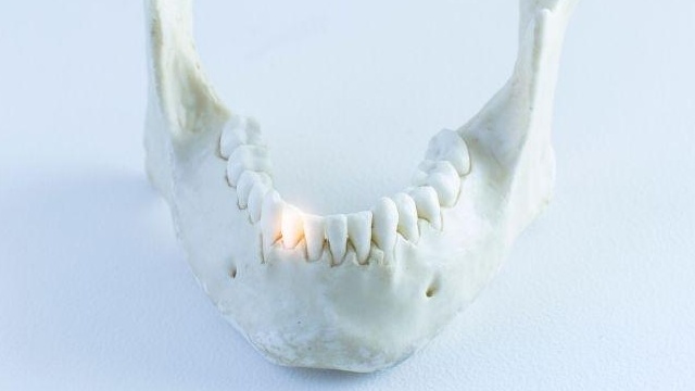 Xương hàm dưới: Giải phẫu, chức năng và một số bệnh liên quan 2