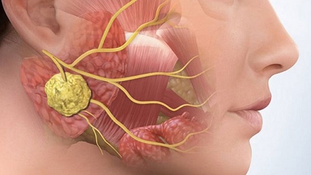 Xương hàm dưới: Giải phẫu, chức năng và một số bệnh liên quan 5