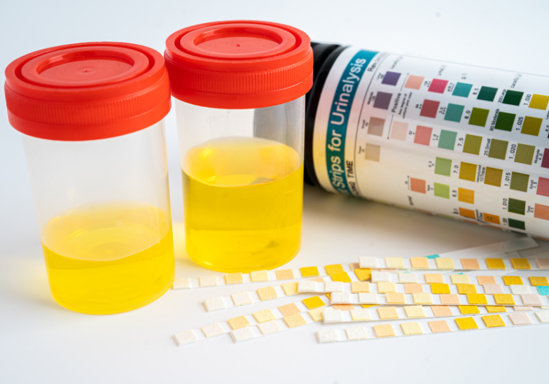 Ý nghĩa về bảng màu nước tiểu của trẻ sơ sinh​ 1